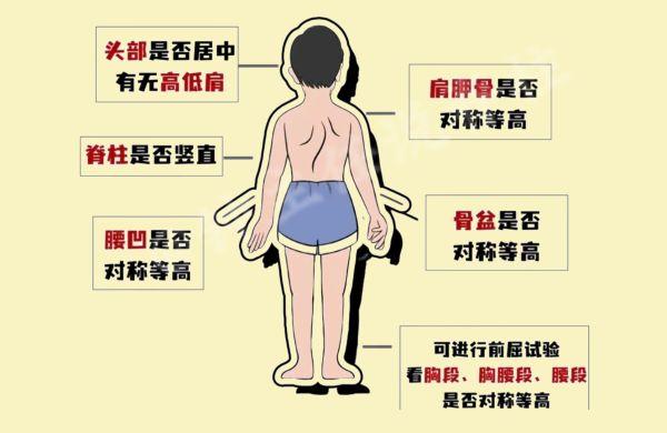 脊柱侧弯体态异常